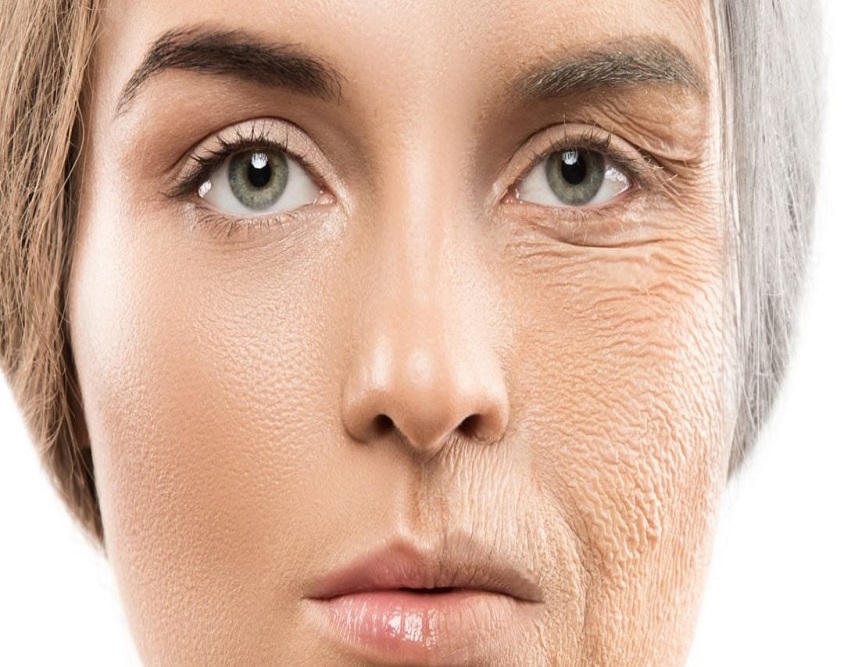 ageing skin